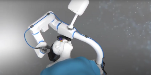 Hearo : un robot chirurgien de l’oreille désormais marqué CE