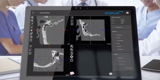 MED-EL lance OTOPLAN, un outil à destination des chirurgiens