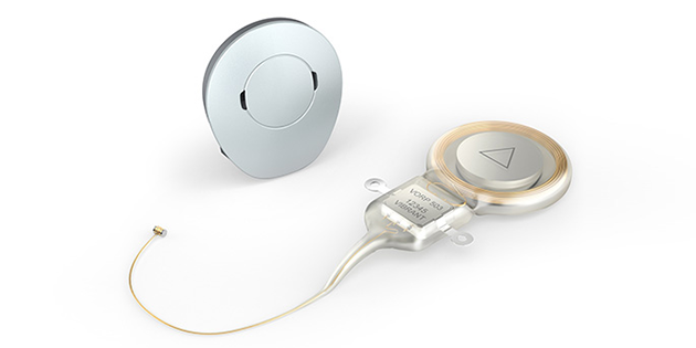 Vibrant Soundbridge : le premier implant d’oreille moyenne pris en charge