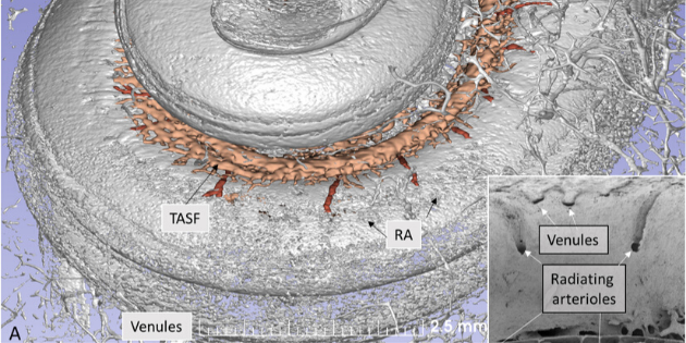 Des chercheurs obtiennent des images 3D de l’irrigation sanguine de l’oreille interne