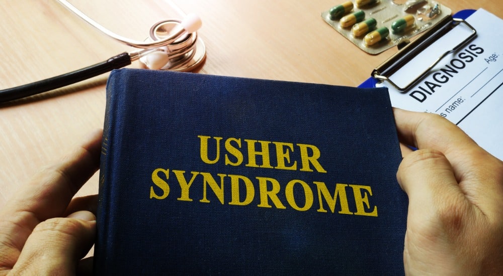 Syndrome d’Usher : des chercheurs ont mis au point un modèle pour tester la thérapie génique