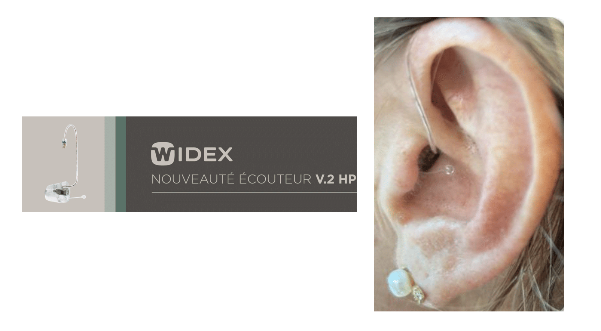 Widex présente un nouvel embout avec écouteur intégré
